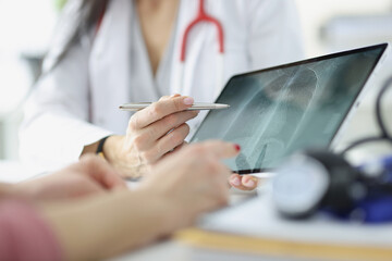 Doctor shows patient an x-ray of lungs on tablet closeup - obrazy, fototapety, plakaty