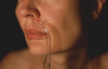 Face of middle-age woman and bend tube of high frequency D'arsonval device over acne spot. Acne...