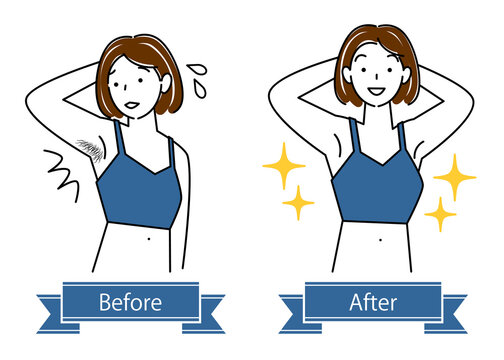 ビフォーアフター Images Browse 3 868 Stock Photos Vectors And Video Adobe Stock