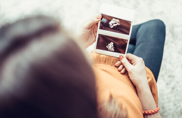 Kobieta w ciąży i zdjęcie USG - obrazy, fototapety, plakaty