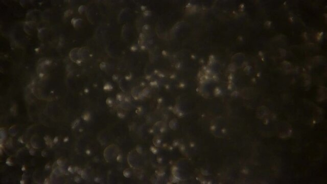 Microscopic sperm cells in warm color temperature light.