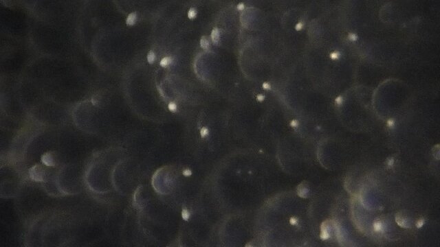 Pan across human sperm cells seen under high magnification.