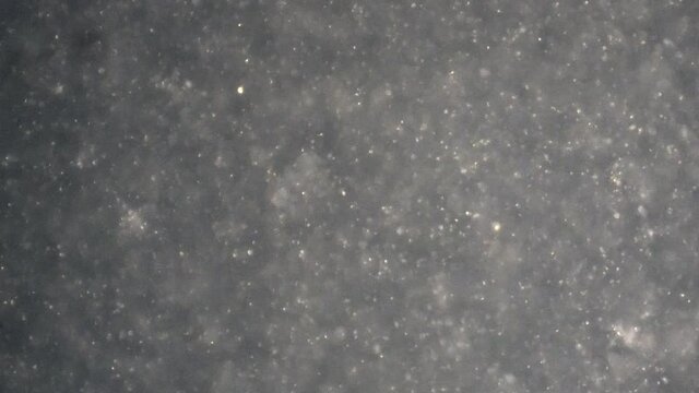 Zoom in on human sperm cells swimming in seminal fluid.