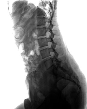 Human spine x-ray. Medical examination test scan