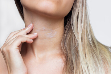 A close-up view of a young woman's neck. The girl uses a cream from the lines on the neck. Wrinkles, age-related changes, rings of Venus, goosebumps. Skin care