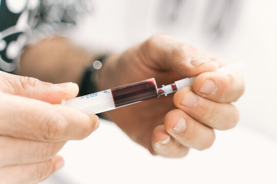 Vet doctor with blood sample