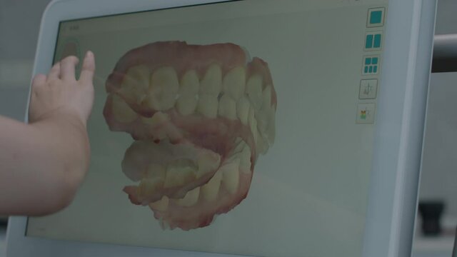 Close up on medical touch screen monitor with teeth 3D scan examined by doctor.