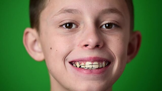 Smile baby, boy wears a plate for aligning teeth, dental care.