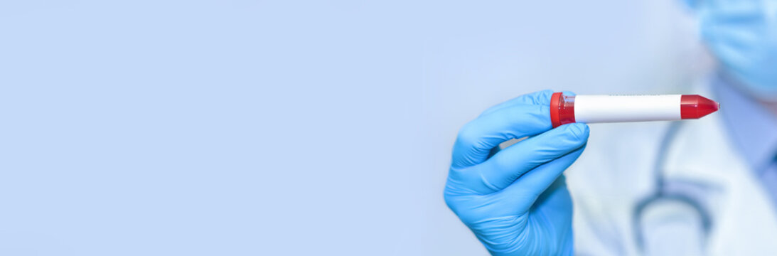 Doctor's hand holds test tube in blood.Banner. Copy space for text