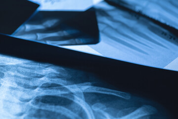 Closeup of different x-ray images