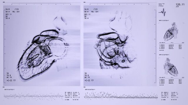 Heart scan front, side view animation. Digital artifacts, dynamic glitches, noise effect. Blood pressure, heart rate displayed on modern high-tech screen. Health data. Diagnosis of diseases. 3D Render