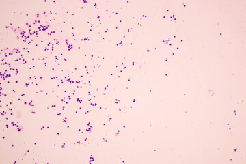 Chromosomes Human under the microscope for education.
