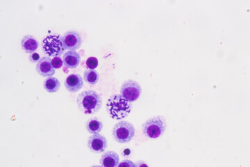 Chromosomes Human under the microscope for education.
