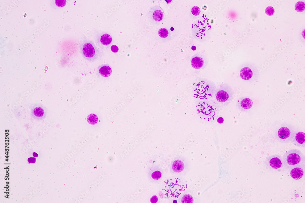 Wall mural Chromosomes Human under the microscope for education.
