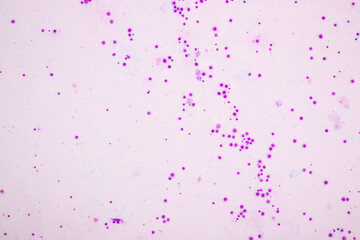 Chromosomes Human under the microscope for education.
