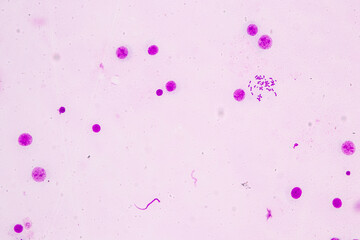 Chromosomes Human under the microscope for education.
