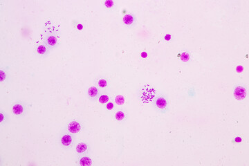 Chromosomes Human under the microscope for education.
