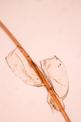 The head louse (Pediculus humanus capitis) is a parasite Live on the body, person or animal and live by sucking blood into food.
