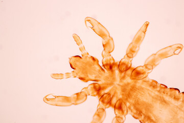 The head louse (Pediculus humanus capitis) is a parasite Live on the body, person or animal and live by sucking blood into food.
 - obrazy, fototapety, plakaty