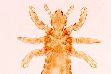 The head louse (Pediculus humanus capitis) is a parasite Live on the body, person or animal and...