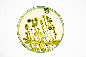 Growing Bacteria in Petri Dishes on agar gel Scientific experiment.