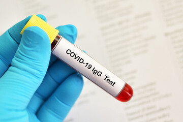 COVID-19 antibody test, blood sample tube for COVID-19 IgG antibody test, after vaccination