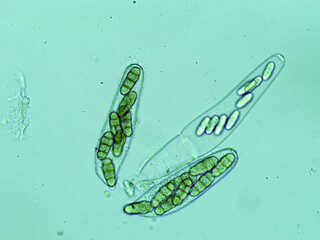 Bags of helminthosporium