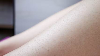 model's legs - close-ups showing black hair, which is removed by sugar epilation.