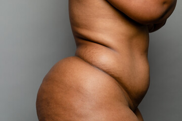 Torso Of Nude Woman From The Side