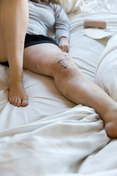 Woman gives stitches fresh air