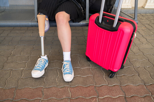 Anonymous Woman With Leg Prosthesis With Suitcase