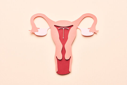 Reproductive system with inserted IUD device.