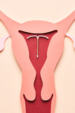 Female organ with IUD device.