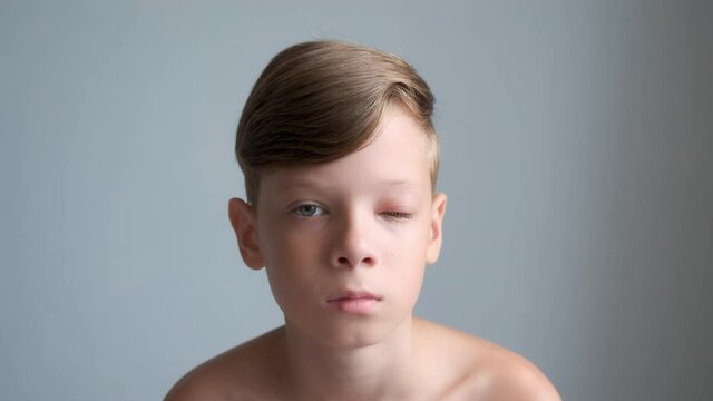 Portrait of a boy with a swollen eye from an insect bite. Allergic reaction to insect bites. Closed red sick eye of a teen boy. Eye disease in a child, conjunctivitis, inflammation in the eye.