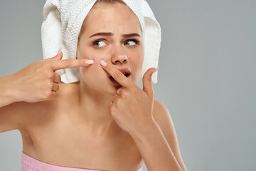 pretty woman with towel on her head squeezes out pimples on her face