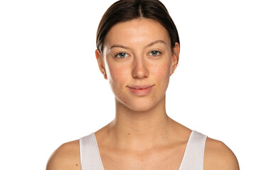 Beautiful smiling woman without makeup and problematic skin