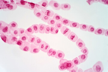 Mitosis cell of root tip of onion under the light microscope.