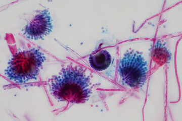 Aspergillus (mold) under the light microscopic view.