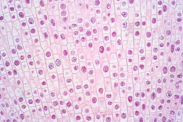 Mitosis cell of root tip of onion under the light microscope.