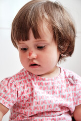 Naklejka premium Close up portrait baby girl with a scratch on her nose isolated on the white background. Child safety concept, injuries from falling down