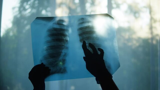 Holding X-ray image of human chest on window background, doctor checking fluorography of patient on light, lungs check-up after coronavirus pandemic. Looking at lungs x-ray with ribs.