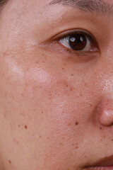 health concept Women skin care problems and wrinkles