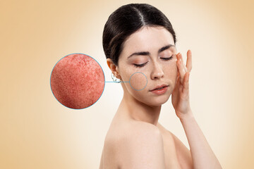 Portrait of a beautiful young woman, with an enlarged circle on her cheek, showing inflamed blood...