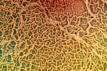 The surface of biological tissue infected with pathogenic microorganisms