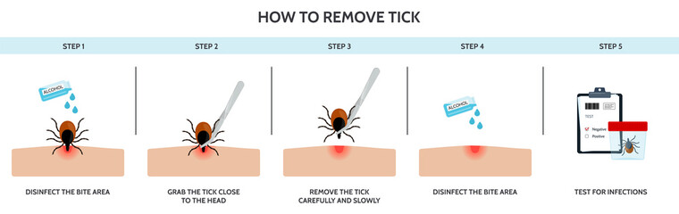 The correct way to remove a tick insect correctly. Prevention of infections transmitted by mite - obrazy, fototapety, plakaty