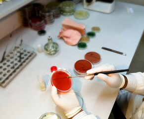 Microbiology, technician working with bacteria strains. stool culture, closeup