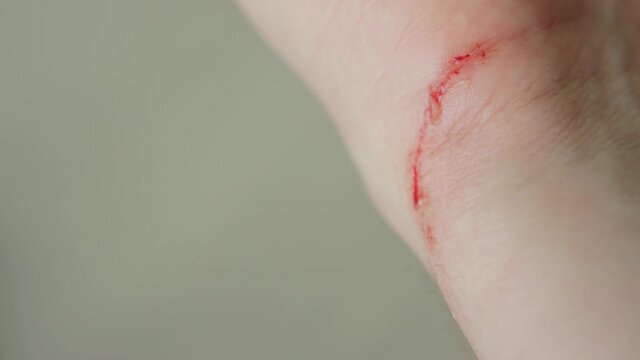 Blood on the wrist of a person's hand, close-up. Cut and wound in the skin