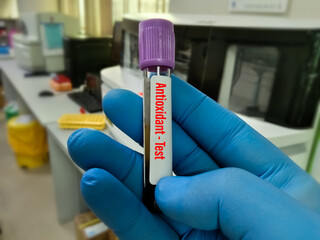 Blood sample tube for Antioxidant test at medical laboratory. To diagnosis Antioxidant toxicity.