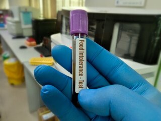 Blood tubes in laboratory for Paratyphoid test. To diagnosis bacterial fever 