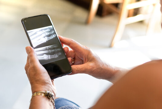 Close up of unrecognized woman watching her x-ray on mobile phone at home, virtual doctor concept.